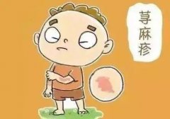 為什么一換季就發(fā)蕁麻疹？該怎么做才好？